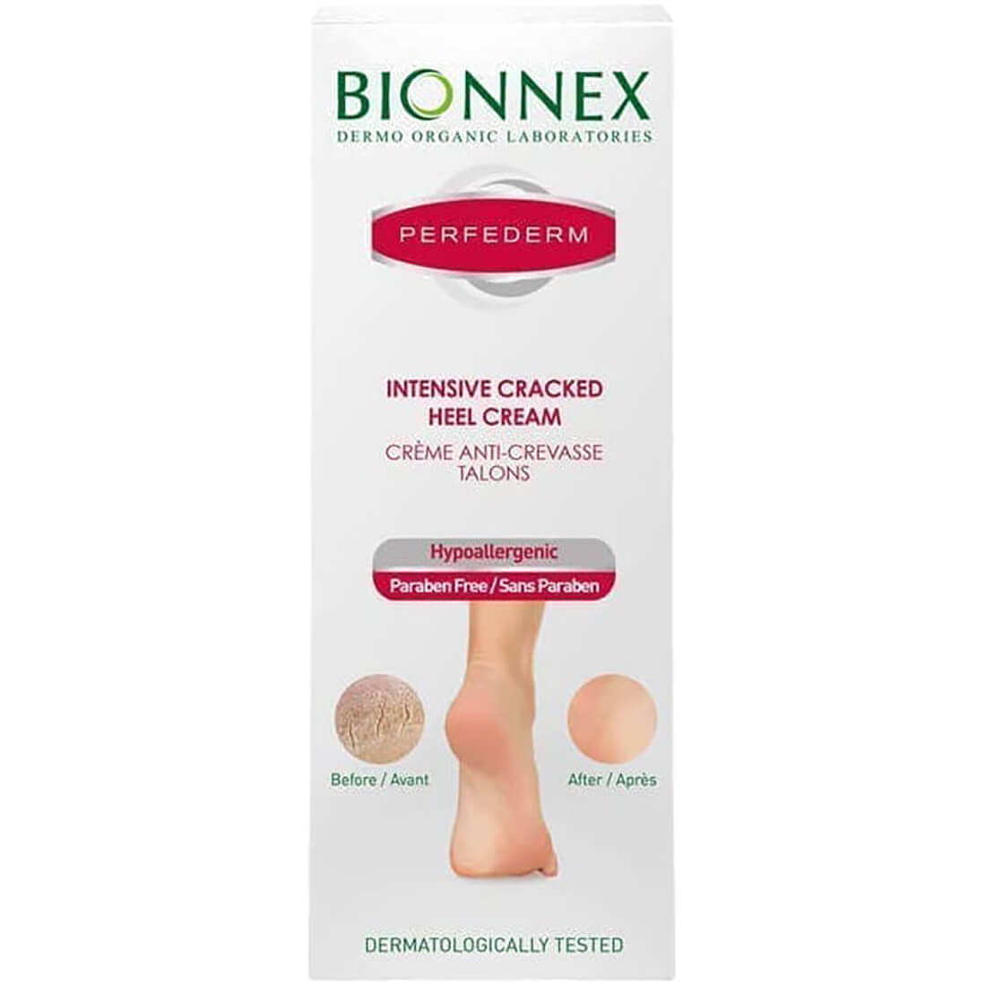 Bionnex Perfederm Intensive Cracked Heel Cream